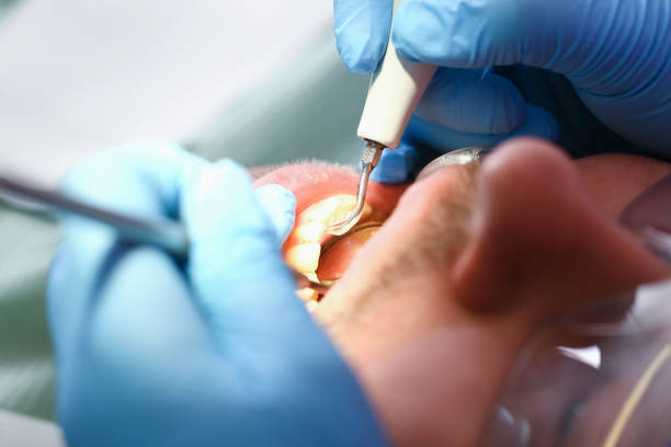Best Emergency Treatment for Toothache in Washingtonville, NY
