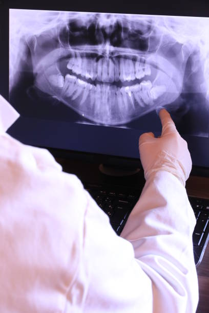 Best Emergency Root Canal Treatment in Washingtonville, NY