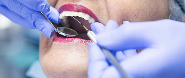 Best Emergency Treatment for Toothache in Washingtonville, NY